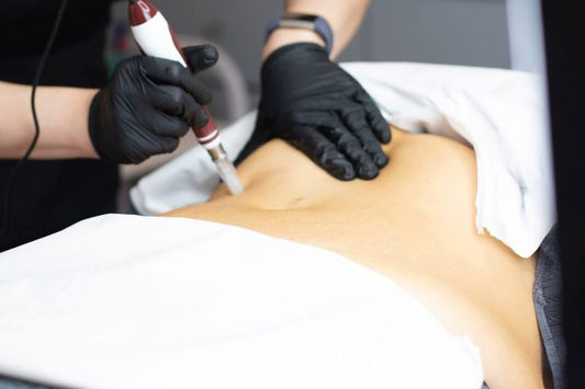 Look your best with the new Combo Microneedling BioRePeel
