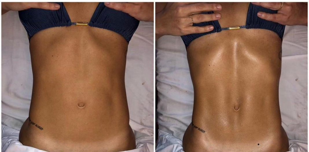 Renata França Method - Lymphatic Drainage
