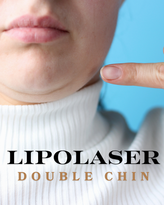 Lipolaser Chin 4 SESSIONS