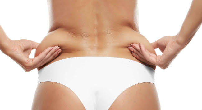 6 Reasons You Have Localized Fat (and the fix)
