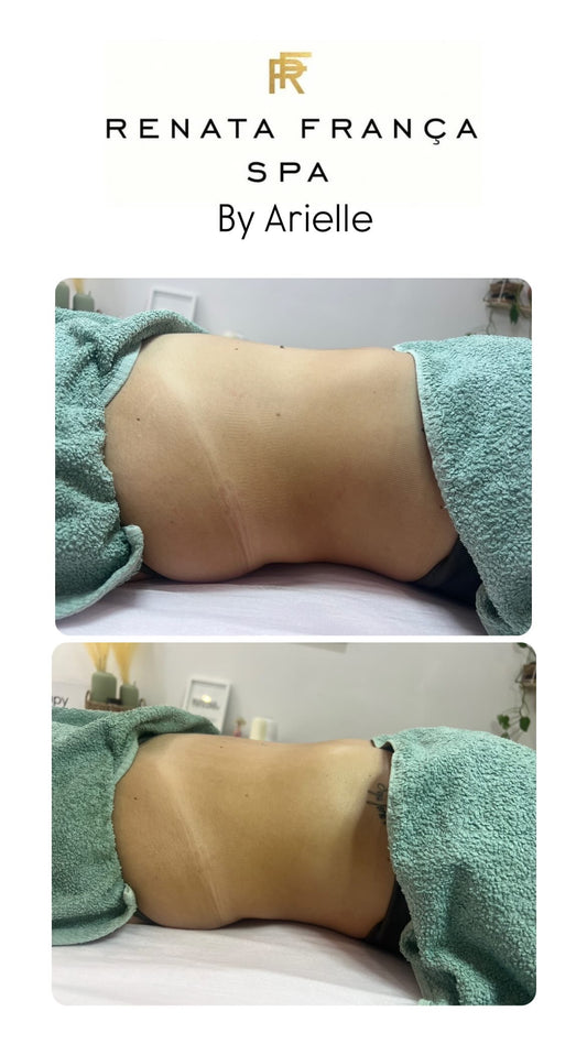 Renata França Method - Lymphatic Drainage