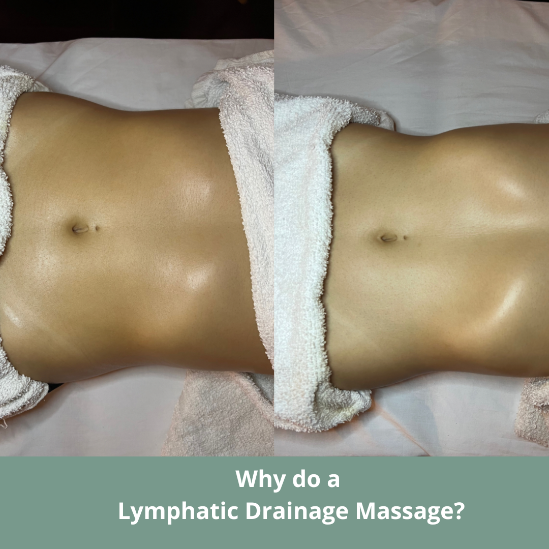 Renata Franca Method - Lymphatic Drainage  (5 Sessions) now €280