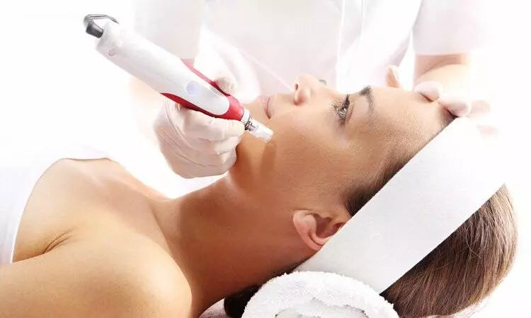 Microneedling with BioRePeel